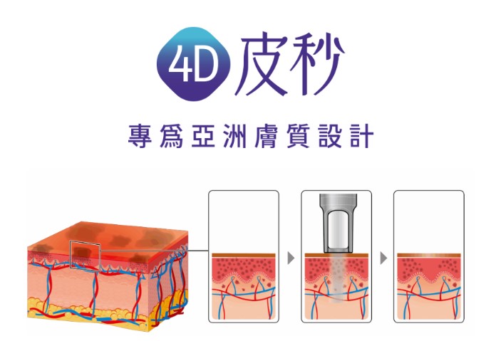 Picoplus 4D皮秒是什麼？ 