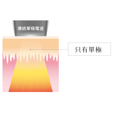無雙電波原理一次看懂:單極+雙極同步啟動