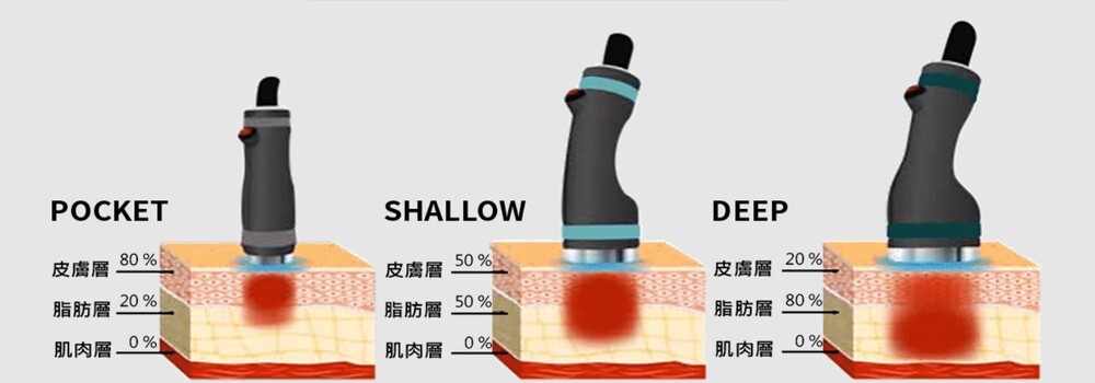 三款專屬探頭設計 